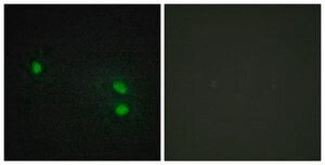 Anti-Histone H2B antibody produced in rabbit affinity isolated antibody