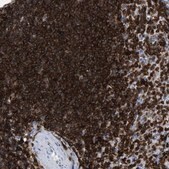 Anti-LCP1 antibody produced in rabbit Prestige Antibodies® Powered by Atlas Antibodies, affinity isolated antibody, buffered aqueous glycerol solution