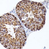Anti-PRMT5 antibody produced in rabbit