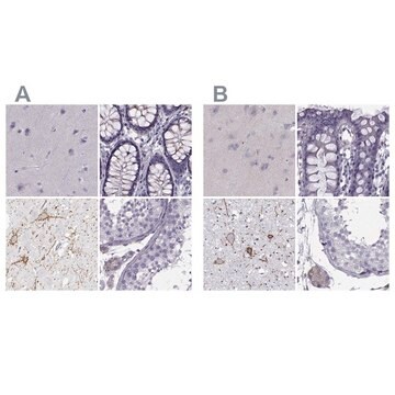 Anti-CALCR antibody produced in rabbit Prestige Antibodies® Powered by Atlas Antibodies, affinity isolated antibody, buffered aqueous glycerol solution