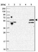Anti-TRIM32 antibody produced in rabbit Prestige Antibodies® Powered by Atlas Antibodies, affinity isolated antibody, buffered aqueous glycerol solution