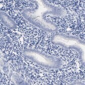 Anti-ACPP antibody produced in rabbit Prestige Antibodies® Powered by Atlas Antibodies, affinity isolated antibody, buffered aqueous glycerol solution