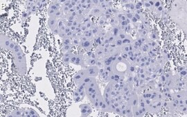 Anti-PPARγ Antibody, clone 1I19 ZooMAb® Rabbit Monoclonal recombinant, expressed in HEK 293 cells