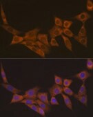 Anti-DCP1A antibody produced in rabbit