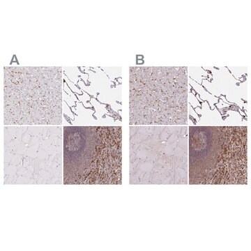 Anti-PYCARD antibody produced in rabbit Prestige Antibodies® Powered by Atlas Antibodies, affinity isolated antibody, buffered aqueous glycerol solution