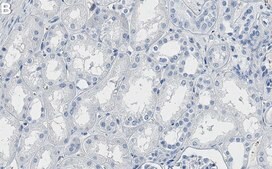 Anti-PDHA1 Antibody, clone 1B13 ZooMAb® Rabbit Monoclonal recombinant, expressed in HEK 293 cells