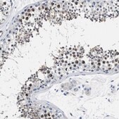 Anti-PARG antibody produced in rabbit Prestige Antibodies® Powered by Atlas Antibodies, affinity isolated antibody, buffered aqueous glycerol solution