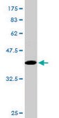 Monoclonal Anti-TWIST1, (C-terminal) antibody produced in mouse clone 2F8, purified immunoglobulin, buffered aqueous solution