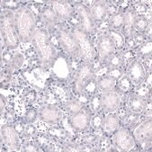 Monoclonal Anti-EOMES antibody produced in mouse Prestige Antibodies® Powered by Atlas Antibodies, clone CL15426, purified antibody (Protein A)