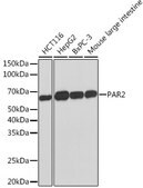Anti-PAR2 Antibody, clone 9X8E6, Rabbit Monoclonal