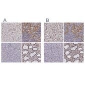 Anti-CD14 antibody produced in rabbit Ab3, Prestige Antibodies® Powered by Atlas Antibodies, affinity isolated antibody, buffered aqueous glycerol solution