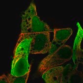 Anti-AKR1C1 antibody produced in rabbit Prestige Antibodies® Powered by Atlas Antibodies, affinity isolated antibody