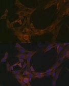 Anti-STK39 antibody produced in rabbit