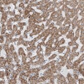 Anti-TNS2 antibody produced in rabbit Prestige Antibodies® Powered by Atlas Antibodies, affinity isolated antibody, buffered aqueous glycerol solution