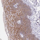 Anti-DSC3 antibody produced in rabbit Prestige Antibodies® Powered by Atlas Antibodies, affinity isolated antibody, buffered aqueous glycerol solution