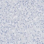 Anti-MYH11 antibody produced in rabbit Prestige Antibodies® Powered by Atlas Antibodies, affinity isolated antibody, buffered aqueous glycerol solution