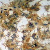 Anti-phospho-TNNI3 (pSer22+Ser23) antibody produced in rabbit affinity isolated antibody