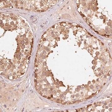 Anti-PARK2 antibody produced in rabbit Prestige Antibodies® Powered by Atlas Antibodies, affinity isolated antibody