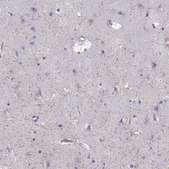 Anti-GRIK4 Prestige Antibodies® Powered by Atlas Antibodies, affinity isolated antibody