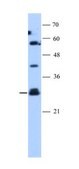 Anti-SOCS1 antibody produced in rabbit IgG fraction of antiserum