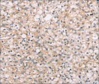 抗-ROR1 affinity isolated antibody