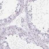 Anti-CACNA1S antibody produced in rabbit Prestige Antibodies® Powered by Atlas Antibodies, affinity isolated antibody, buffered aqueous glycerol solution