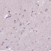 Anti-HSPA2 antibody produced in rabbit Prestige Antibodies® Powered by Atlas Antibodies, affinity isolated antibody, buffered aqueous glycerol solution