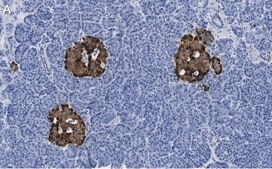 Anti-Chromogranin A Antibody, clone 5F23 ZooMAb® Rabbit Monoclonal recombinant, expressed in HEK 293 cells