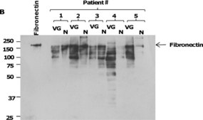抗-纤连蛋白 兔抗 affinity isolated antibody, buffered aqueous solution