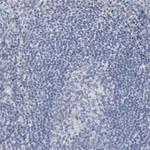 Anti-SALL2 antibody produced in rabbit Prestige Antibodies® Powered by Atlas Antibodies, affinity isolated antibody, buffered aqueous glycerol solution