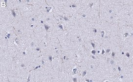 Anti-PTEN Antibody, clone A2b1 ZooMAb® Mouse Monoclonal recombinant, expressed in HEK 293 cells