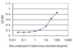 Monoclonal Anti-ASPA antibody produced in mouse clone 3C11, purified immunoglobulin, buffered aqueous solution