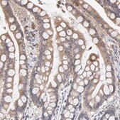 Anti-SGPL1 antibody produced in rabbit Prestige Antibodies® Powered by Atlas Antibodies, affinity isolated antibody, buffered aqueous glycerol solution