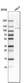 Anti-OGT antibody produced in rabbit Prestige Antibodies® Powered by Atlas Antibodies, affinity isolated antibody, buffered aqueous glycerol solution, ab1