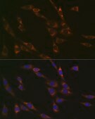 Anti-RPS3 Antibody, clone 3X2M4, Rabbit Monoclonal
