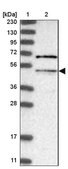 Anti-MLYCD antibody produced in rabbit Prestige Antibodies® Powered by Atlas Antibodies, affinity isolated antibody, buffered aqueous glycerol solution