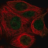 Anti-TBP antibody produced in rabbit Prestige Antibodies® Powered by Atlas Antibodies, affinity isolated antibody, buffered aqueous glycerol solution