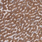 Anti-PGRMC1 antibody produced in rabbit Prestige Antibodies® Powered by Atlas Antibodies, affinity isolated antibody, buffered aqueous glycerol solution