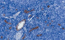 Anti-vWF Antibody, clone 1B21, ZooMAb® Rabbit Monoclonal recombinant, expressed in HEK 293 cells