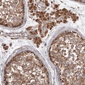 Anti-CDK5RAP3 antibody produced in rabbit Prestige Antibodies® Powered by Atlas Antibodies, affinity isolated antibody, buffered aqueous glycerol solution