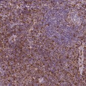 Monoclonal Anti-S100A4 antibody produced in mouse Prestige Antibodies® Powered by Atlas Antibodies, clone CL0239, purified immunoglobulin, buffered aqueous glycerol solution