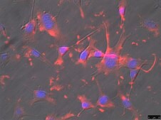 OSUMMER.7 Mouse NRAS-Mutant Melanoma Cell Line