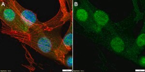 Anti-S100A4 Antibody, clone 1G2 ZooMAb® Rabbit Monoclonal recombinant, expressed in HEK 293 cells