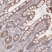 Anti-LRP5 antibody produced in rabbit Prestige Antibodies® Powered by Atlas Antibodies, affinity isolated antibody, buffered aqueous glycerol solution