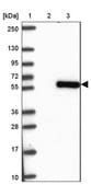 Anti-SMAD5 antibody produced in rabbit Prestige Antibodies® Powered by Atlas Antibodies, affinity isolated antibody, buffered aqueous glycerol solution