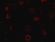 Anti-CXCR4-Lo antibody produced in rabbit purified immunoglobulin (IgG)