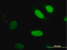 单克隆抗 YAP1 小鼠抗 clone 2F12, purified immunoglobulin, buffered aqueous solution