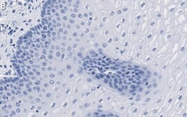 Anti-Involucrin Antibody, clone 1D13 ZooMAb® Rabbit Monoclonal recombinant, expressed in HEK 293 cells