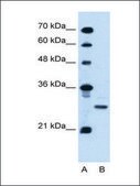 Anti-PDPN antibody produced in rabbit affinity isolated antibody