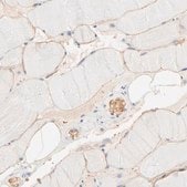 Anti-SPTB antibody produced in rabbit Ab1, Prestige Antibodies® Powered by Atlas Antibodies, affinity isolated antibody, buffered aqueous glycerol solution